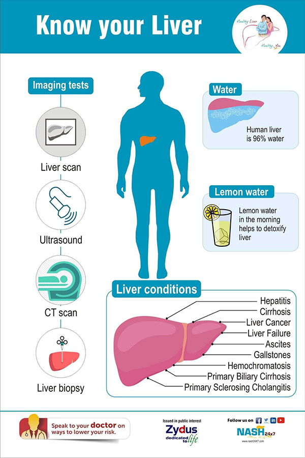 Non alcoholic liver disease