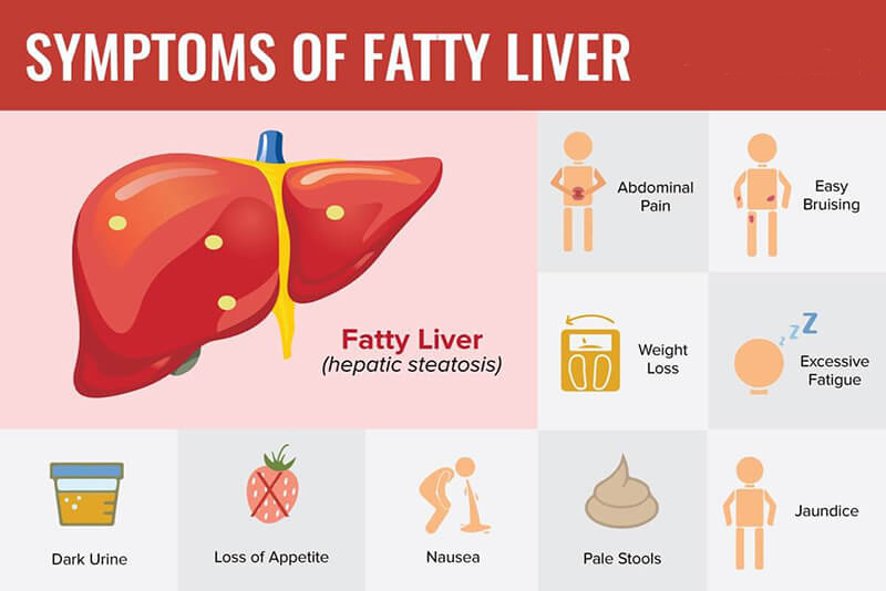 How Nash And Fatty Liver Effects Daily Functioning Of The Liver